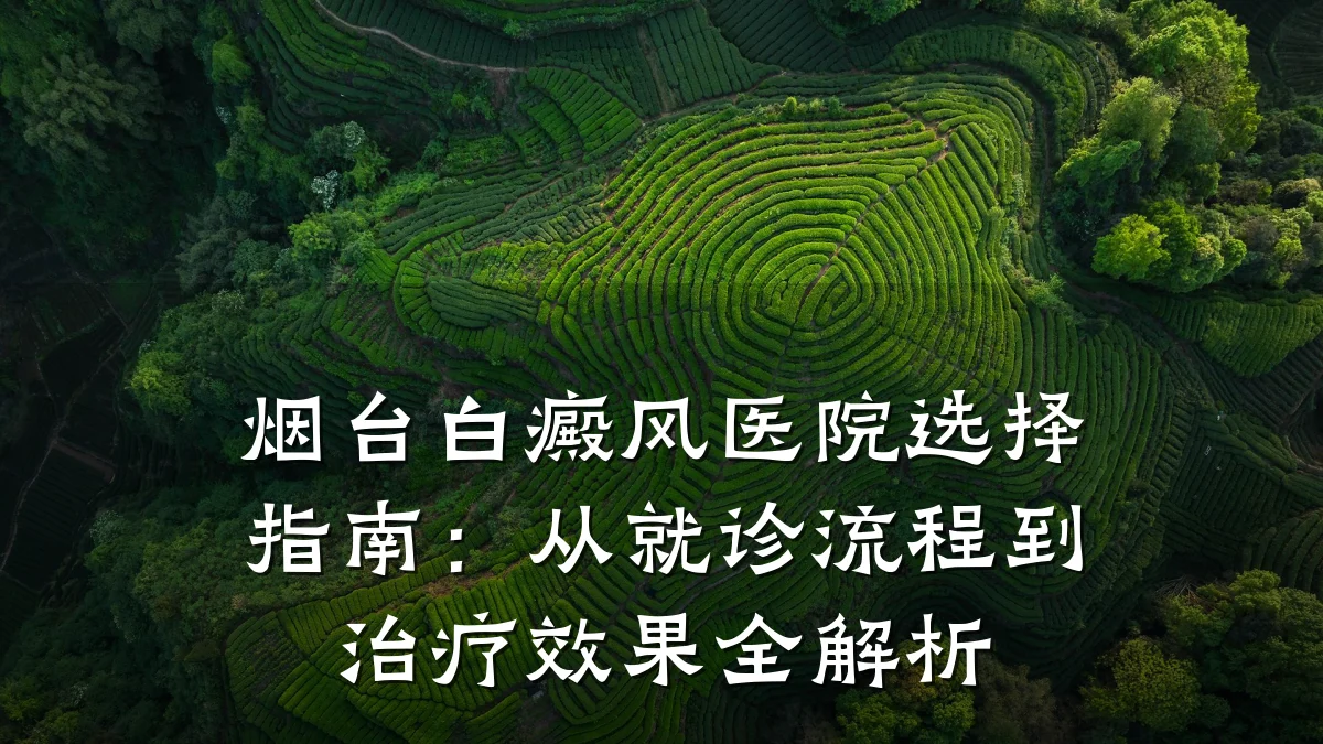 烟台白癜风医院选择指南:从就诊流程到治疗效果全解析